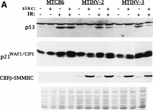 Fig. 1. CBFβ-SMMHC inhibits p53 induction but induces p21WAF1/CIP1 in Ba/F3 cells exposed to IR or VP-16. (A) MTCB6 cells (vector-transfected) and MTINV-2 or MTINV-3 cells (expressing CBFβ-SMMHC from the MT promoter) were cultured ± 100 μmol/L zinc chloride for 18 hours. Half of the cells from each of these four cultures were then irradiated to 10 Gy. Cells exposed initially to zinc were continued in zinc after irradiation. Total cellular protein extracts were prepared 90 minutes later and electrophoresed on a 10% sodium dodecyl sulfate–polyacrylamide gel. The proteins were then transferred to a nitrocellulose filter, which was stained with Fast Green to control protein loaded (bottom panel) and subjected to Western blotting with antisera specific for murine p53, p21WAF1/CIP1, and CBFβ. The latter antisera detected CBFβ-SMMHC, which was induced by zinc in the MTINV-2 and MTINV-3 cells. (B) MTCB6 and MTINV-3 cells were cultured ± zinc for 18 hours. The cells were then exposed to 8 μg/mL VP-16 for 150 minutes in the presence or absence of IL-3. Total cellular extracts were then prepared and subjected to Western blotting for p53, p21, and CBFβ, with CBFβ levels serving as a control for protein loading.