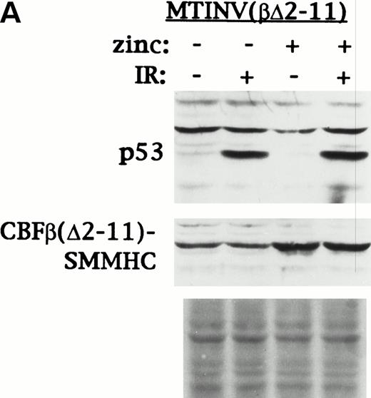 Fig. 7. CBFβ-SMMHC must interact with CBF and inhibit CBF transactivation to attenuate p53 induction, and reduces p53 mRNA expression in Ba/F3 cells. (A) MTINV(β▵2-11) Ba/F3 cells, which express a CBFβ-SMMHC variant that cannot bind CBF, were cultured ± 100 μmol/L zinc chloride for 18 hours. Half of the cells from each of these cultures were then irradiated to 10 Gy. Cells exposed initially to zinc were continued in zinc after irradiation. Total cellular protein extracts were prepared 90 minutes later and subjected to Western blotting with antisera specific for murine p53 and CBFβ-SMMHC. Fast Green staining of the blot is shown as a control for protein loading. (B) MTCB6 and MTINV-3 cells were cultured ± zinc for 18 hours. Poly-A–containing mRNA was then prepared from each culture. Five micrograms of each sample was subjected to electrophoresis on a 1% formaldehyde-agarose gel, transferred to a nylon membrane, and probed sequentially for p53, mdm2, and actin.