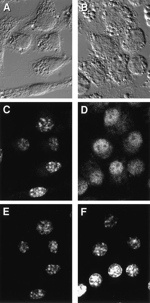 Fig. 5. CM alters the morphology of P388D1(IL1) macrophages. Cells were treated with UCM (A, C, and E) or CM (B, D, and F) for 16 hours and their morphology assessed. Fixed cells were visualized with Nemarsky optics (A and B) on a Zeiss LSM 310 confocal microscope. C/EBPβ localization (C and D) and DAPI staining (E and F) were analyzed as described in the legend to Fig 4.