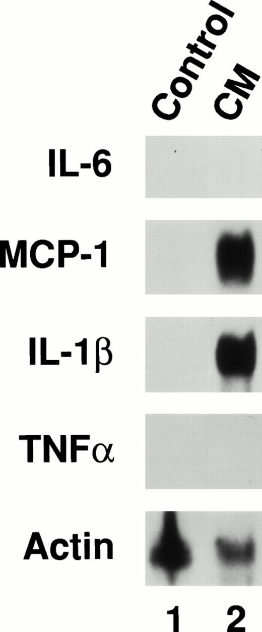 Fig. 8. CM induces expression of endogenous cytokine genes. P388D1(IL1) cells were grown in serum-free medium in the presence or absence of CM for 16 hours. RNA was harvested and analyzed by Northern blotting using probes for IL-6, MCP-1, IL-1β, TNF-, and β-actin. The blot was hybridized sequentially with the five probes.