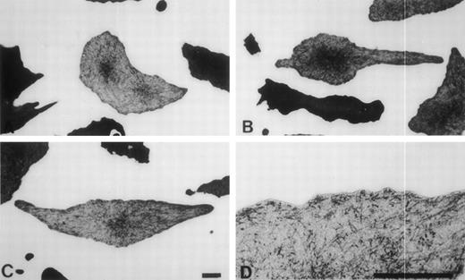 Fig. 6. Transmission electron microscopy of “yarn/knitting needle” RBCs when deoxygenated in vitro. “Yarn/knitting” RBCs are irreversibly sickled cells, that is their shape does not change according to the presence or absence of intracellular polymer. These cells were likely formed by the presence of a single domain of polymer transecting the cell and growing to the extent that the membrane loses its elasticity and the deformation becomes permanent. By deoxygenating peripheral blood from a patient with a high expression of S-Oman we observed the type of domain formation that occurs in these cells. Notice that a single large domain is forming in the center (B and C), but much smaller domains are also formed, in the distal extension of the membrane as well as immediately under the membrane, as magnified in (D). (A) This RBC has a “banana” shape, capable of accommodating two long polymer domains separated by an angle approaching 180°: indeed, two major domains are being formed upon in vitro deoxygenation in these cells, following the requirement of the already established irreversibly deformed shape.