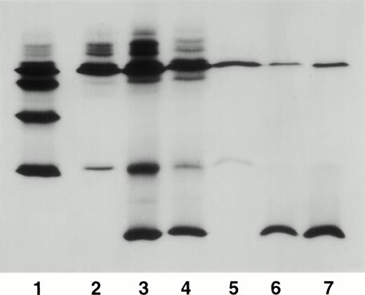 Fig. 7. Isoelectrofocusing separation of the Hb tetramers present in supernatant 1 and supernatant 2 (see Materials and Methods). Lane 1, markers for HbS A, F, S, and C(A2) (from the top down). Lane 2, supernatant 1 of a normal hemolysate (HbA, traces of HbF and low levels of HbA2; the bands in front of HbA are postranslational modifications of HbA). Lane 3, supernatant 1 of patient SSR (HbA, low amounts of HbF and HbA2 and the slowest fraction, HbS-Oman). Lane 4, supernatant 1 of patient ISH (high S-Oman, similar distribution to that in 3 but less loaded). Lane 5, supernatant 2 of a normal hemolysate (HbA and very little A2). Lane 6, supernatant 2 of patient SSR, dramatic reduction of HbA and large increase in HbS-Oman. Lane 7, supernatant of patient ISH, very similar results that in lane 6. For quantification, see the text.