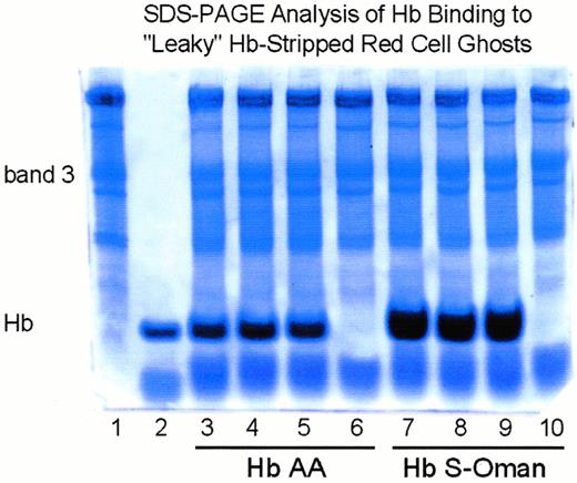 Fig. 8. Increased binding of HbS-Oman to normal (HbAA) Hb-stripped “leaky” RBC ghost membranes. SDS-PAGE (7.5% acrylamide), using the Fairbanks discontinuous buffer system, stained with Coomassie brilliant blue of purified HbAA or HbS-Oman incubated with normal (HbAA) Hb-stripped “leaky” RBC ghost membranes. Lane 1, normal (HbAA) Hb-stripped “leaky” ghosts; lane 2, 0.005 mg purified HbS-Oman; lanes 3 through 5, “leaky” ghosts incubated with HbAA; lanes 6 and 10, “leaky” ghosts without added Hb; lanes 7 through 9, “leaky” ghosts incubated with HbS-Oman. The position of band 3 and Hb is indicated. There was considerably more binding of HbS-Oman to “leaky” ghosts compared with the binding of HbAA.