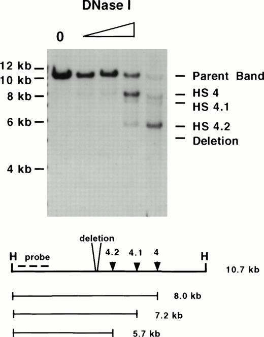 Fig. 5. Mapping of HSs in homozygous ▵5,6 ▵H/▵5,6 ▵H mice. A DNase I series of erythroid tissue from a homozygous mutant mouse was digested with Hpa I (H) and hybridized with a 5′ probe (the same enzyme and probe combination as used in Fig4). Although 5′ HS 4, 4.1, and 4.2 form, no HS forms at the site of the deletion. Molecular size standards are marked on the left. The size of the parent band, placement of the probe used, and the size of the degradation bands are diagrammed below.