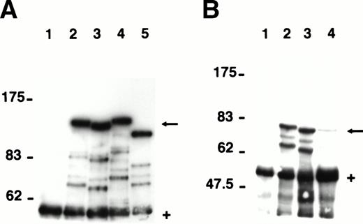 Fig. 4. Expression of the seven major protein 4.1R isoforms in transfected COS-7 cells. The major 4.1R isoforms identified by RT-PCR of erythroblast total RNA were expressed as HA-epitope–tagged proteins in transfected COS-7 cells. Proteins were immunoprecipitated from precleared cell lysates using a polyclonal anti–HA-epitope tag antibody and analyzed by SDS-PAGE on a 6% (A) or 7% (B) acrylamide gel. (A) Cells transfected with empty expression vector (lane 1); HA-tagged 4.1R135 (lane 2); HA-tagged 4.1R135▵E16 (lane 3); HA-tagged 4.1R135+E14 (lane 4); and HA-tagged 4.1R135▵E4 (lane 5). (B) Cells transfected with empty expression vector (lane 1); HA-tagged 4.1R80 (lane 2); HA-tagged 4.1R80▵E16 (lane 3); HA-tagged 4.1R80▵E5 (lane 4). HA-tagged 4.1R isoforms (←). IgG heavy chains migrating ∼55 kD (+). Fainter bands migrating between the HA-epitope–tagged proteins and IgG heavy chains are likely to represent proteolytic fragments of the epitope tagged proteins (see Results). Note that 4.1R80▵E5 is expressed at a much lower level than the other 4.1R isoforms.