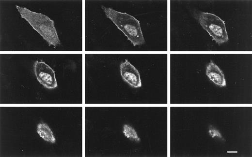 Fig. 7. Confocal z-sections of a NIH/3T3 cell transfected with KT3-epitope–tagged 4.1R80. NIH/3T3 cells were transfected with KT3-epitope–tagged 4.1-R80, fixed with 3% paraformaldehyde, permeabilized with 0.5% Triton X-100, and processed for immunofluorescence using a monoclonal anti–KT3-epitope tag antibody as a primary antibody and anti-mouse IgG coupled to Texas red as a secondary antibody. Cells were analyzed by confocal microscopy. The 4.1R80 isoform was strongly expressed in the nucleus, the plasma membrane, and apparent centrosomes. Every other z-section of a series of 18 0.5-μm z-sections are displayed. Scale bar: 10 μm.