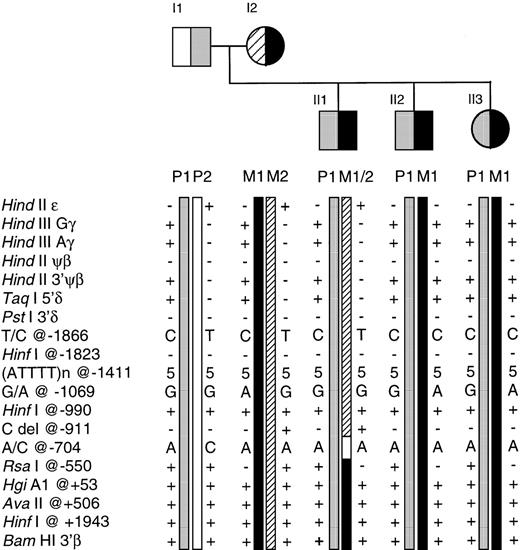 Fig. 2. The Greek Cypriot family illustrating segregation of the β haplotypes and informative recombination events. Both parents are heterozygotes (β+ 33 C → G in I1 and βo39 C → T in I2) and all three offspring, compound heterozygotes for β-thalassemia. β Haplotypes P1 and M1 are associated with the paternal and maternal β-thalassemia alleles, respectively. While individuals II2 and II3 have inherited the P1 and M1 haplotypes intact, individual II1 has inherited P1 and a maternal recombinant chromosome, as identified by the haplotype M1/M2. The site of recombination is located within the 361-bp interval between positions −911 and −550 relative to the β-globin gene cap site.
