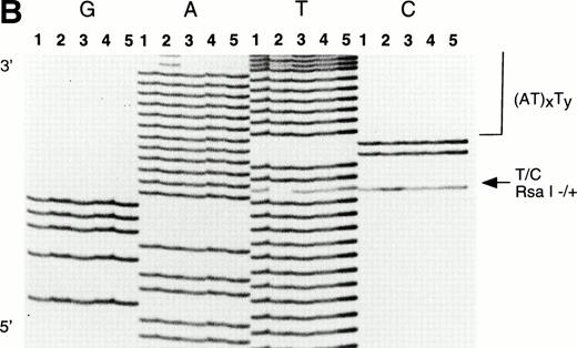 Fig. 3. DNA sequence immediately 5′ of the β-globin gene in the Greek Cypriot family. The individuals II1, I1, I2, II2, and II3 (as shown in Fig 2) are represented by lanes 1, 2, 3, 4, and 5. The termination reactions are loaded in consecutive lanes in a block, ddGTP (G), ddATP (A), ddTTP (T), and ddCTP (C). (Panel A) The 5′ breakpoint indicated by the 1-bp deletion (arrowed) at position −911; (Panel B) the 3′ breakpoint indicated by the arrow (Rsa I site) at position −550.