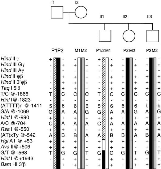 Fig. 4. The Asian Indian family showing segregation of the β haplotypes and informative recombination events. Individual II1 has inherited a paternal recombinant chromosome, as identified by the haplotype P1/P2. The site of recombination is located within a region of ∼1,100 bp between the (AT)xTy repeats at position −542 and the G/T polymorphism at position +568. (AT)xTy at position −542 is represented by A: (AT)7T7 and B: (AT)9T5.