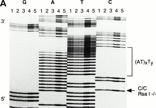 Fig. 5. DNA sequence of the 5′ region of the β-globin gene in the Asian Indian family. The individuals I1, I2, II1, II2, and II3 (as in Fig 4) are represented by lanes 1, 2, 3, 4, and 5, respectively. The termination reactions are loaded in consecutive lanes in a block, ddGTP (G), ddATP (A), ddTTP (T), and ddCTP (C). (a) The 5′ breakpoint of the crossover region is located in the region of the (AT)xTy repeats; (b) the 3′ breakpoint is located at the G/T polymorphic site at position +568 (arrowed).