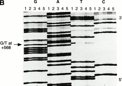 Fig. 5. DNA sequence of the 5′ region of the β-globin gene in the Asian Indian family. The individuals I1, I2, II1, II2, and II3 (as in Fig 4) are represented by lanes 1, 2, 3, 4, and 5, respectively. The termination reactions are loaded in consecutive lanes in a block, ddGTP (G), ddATP (A), ddTTP (T), and ddCTP (C). (a) The 5′ breakpoint of the crossover region is located in the region of the (AT)xTy repeats; (b) the 3′ breakpoint is located at the G/T polymorphic site at position +568 (arrowed).