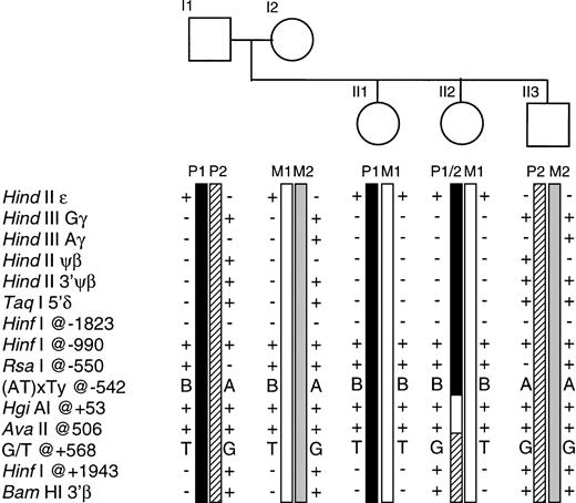 Fig. 6. The Amish family showing segregation of the β haplotypes and informative recombination events. Individual II2 has inherited a paternal recombinant chromosome as identified by the haplotype P1/P2. The site of recombination is located within a region of ∼1,100 bp between the (AT)xTy repeats at position −542 and the G/T polymorphic site at position +568. (AT)xTy is represented by A: (AT)7T7 and B: (AT) 9T5.