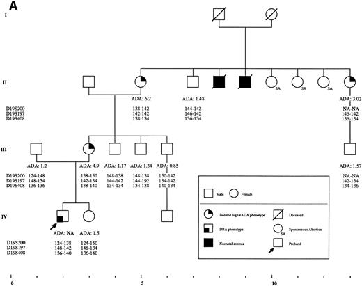 Fig. 2. Pedigrees of families simultaneously showing DBA and isolated high eADA phenotype. (A) Recombination events occurred on meiosis from individuals III-3 and II-5. Allele sizes for microsatellite D19S200 could not be determined for individuals II-13 and III-13, and they were therefore not included in the haplotype analysis. (B) Unlike the three DBA cases of this family, individual II-1 was previously diagnosed as transient erythroblastopenia, and her mother (I-3) was healthy. (C) DBA index case of this family (patient IV-6) responded to interleukin-3 and is still independent of transfusions and steroids on the long-term follow-up. (D) All three siblings showed high eADA levels (II-1, -2, -3) and have normal blood count and hemoglobin electrophoresis, without known history of anemia. (E) Individuals I-2 and II-3 show classical DBA phenotype. eADA of individual II-2 was found increased at birth and remains over normal limits without any episode of anemia, and no other biological abnormality. eADA measurements of individuals I-1 and I-3 were performed in another laboratory, and results are within normal values for the technique considered. (F) Individual II-3 does not share the same haplotype as the DBA index case of the family. NA, not available.
