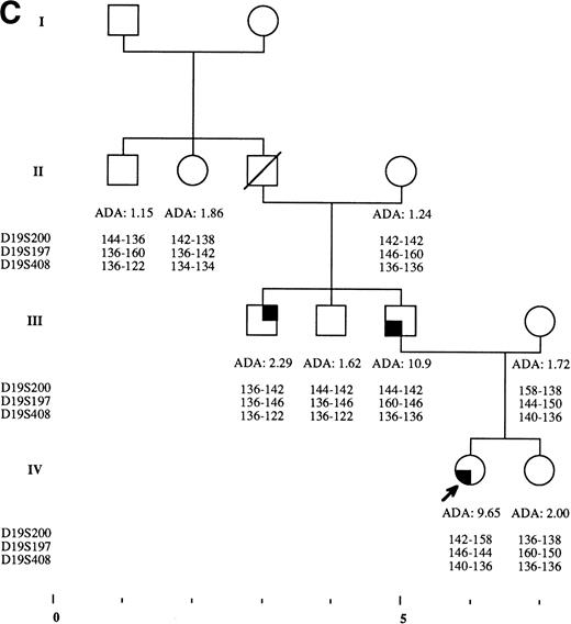 Fig. 2. Pedigrees of families simultaneously showing DBA and isolated high eADA phenotype. (A) Recombination events occurred on meiosis from individuals III-3 and II-5. Allele sizes for microsatellite D19S200 could not be determined for individuals II-13 and III-13, and they were therefore not included in the haplotype analysis. (B) Unlike the three DBA cases of this family, individual II-1 was previously diagnosed as transient erythroblastopenia, and her mother (I-3) was healthy. (C) DBA index case of this family (patient IV-6) responded to interleukin-3 and is still independent of transfusions and steroids on the long-term follow-up. (D) All three siblings showed high eADA levels (II-1, -2, -3) and have normal blood count and hemoglobin electrophoresis, without known history of anemia. (E) Individuals I-2 and II-3 show classical DBA phenotype. eADA of individual II-2 was found increased at birth and remains over normal limits without any episode of anemia, and no other biological abnormality. eADA measurements of individuals I-1 and I-3 were performed in another laboratory, and results are within normal values for the technique considered. (F) Individual II-3 does not share the same haplotype as the DBA index case of the family. NA, not available.