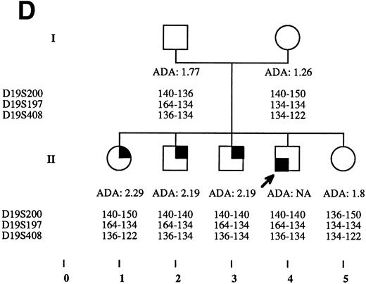 Fig. 2. Pedigrees of families simultaneously showing DBA and isolated high eADA phenotype. (A) Recombination events occurred on meiosis from individuals III-3 and II-5. Allele sizes for microsatellite D19S200 could not be determined for individuals II-13 and III-13, and they were therefore not included in the haplotype analysis. (B) Unlike the three DBA cases of this family, individual II-1 was previously diagnosed as transient erythroblastopenia, and her mother (I-3) was healthy. (C) DBA index case of this family (patient IV-6) responded to interleukin-3 and is still independent of transfusions and steroids on the long-term follow-up. (D) All three siblings showed high eADA levels (II-1, -2, -3) and have normal blood count and hemoglobin electrophoresis, without known history of anemia. (E) Individuals I-2 and II-3 show classical DBA phenotype. eADA of individual II-2 was found increased at birth and remains over normal limits without any episode of anemia, and no other biological abnormality. eADA measurements of individuals I-1 and I-3 were performed in another laboratory, and results are within normal values for the technique considered. (F) Individual II-3 does not share the same haplotype as the DBA index case of the family. NA, not available.