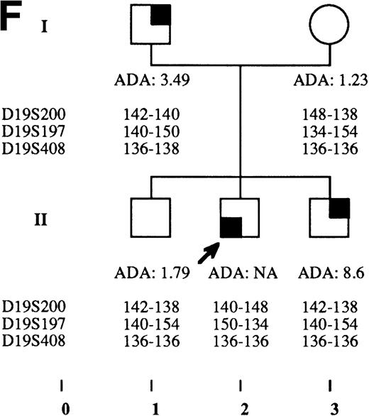 Fig. 2. Pedigrees of families simultaneously showing DBA and isolated high eADA phenotype. (A) Recombination events occurred on meiosis from individuals III-3 and II-5. Allele sizes for microsatellite D19S200 could not be determined for individuals II-13 and III-13, and they were therefore not included in the haplotype analysis. (B) Unlike the three DBA cases of this family, individual II-1 was previously diagnosed as transient erythroblastopenia, and her mother (I-3) was healthy. (C) DBA index case of this family (patient IV-6) responded to interleukin-3 and is still independent of transfusions and steroids on the long-term follow-up. (D) All three siblings showed high eADA levels (II-1, -2, -3) and have normal blood count and hemoglobin electrophoresis, without known history of anemia. (E) Individuals I-2 and II-3 show classical DBA phenotype. eADA of individual II-2 was found increased at birth and remains over normal limits without any episode of anemia, and no other biological abnormality. eADA measurements of individuals I-1 and I-3 were performed in another laboratory, and results are within normal values for the technique considered. (F) Individual II-3 does not share the same haplotype as the DBA index case of the family. NA, not available.