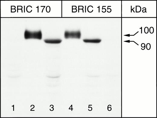 Fig. 2. Immunoblotting of K562 cells for band 3, 8% Laemmli gel. Lanes 1 and 6, K562/pBp; lanes 2 and 4, homozygous Memphis RBC ghosts; lanes 3 and 5, K562/B3 clone 1. BRIC 155 is a murine monoclonal antibody directed against an intracellular site at the C-terminus of band 3, while BRIC 170 binds to the N-terminal cytosolic domain of band 3.