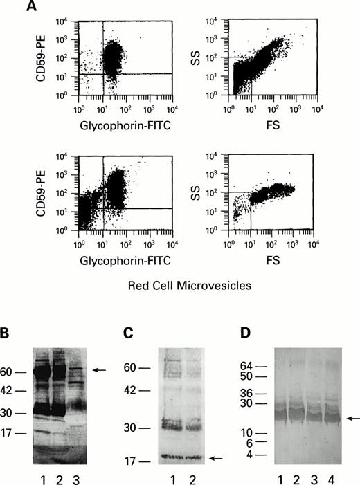 Fig. 1. (A) Flow cytometric analysis of RBC microvesicles shed from stored RBC. Two units of packed RBC units, stored for 35 days at 4°C, were washed with PBS. RBC microvesicles were gated by forward scatter/side scatter to include microparticles, smaller than RBCs, staining with antiglycophorin; scattergrams with gates can be seen on the right. Gated microvesicles of the two units (above and below) stained with CD59 and antiglycophorin are demonstrated on the left. (B and C) Immunoblot of RBC eluate, microvesicles, and HDL. Samples of RBC eluates (1), microvesicles (2), and HDL (3) were solubilized with 3% SDS and analyzed by immunoblot (on 12% polyacrylamide gel) with CD55 (B), CD59 (C) MoAbs. Bands at 19 (B) and 60 kD (C) correspond to CD59 and CD55, respectively. (D) Immunoblots of four commercial HDL preparations (labeled 1 through 4) stained with CD59 MoAb (on 14% polyacylamide gel). A band at 19 kD corresponds to CD59.