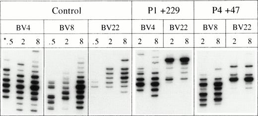 Fig. 2. Comparison of spectratypes of a normal control and two patients 229 and 47 days after transplantation. *The respective lanes show the bands generated by 500, 2,000, and 8,000 (CD3+) T cells after PCR amplification with the BV-specific primers.