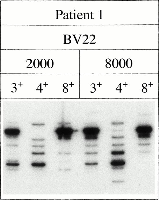 Fig. 3. The dominant bands represent single CD4+ or CD8+ T-cell clones. The data represent the number of bands generated by either 2,000 or 8,000 cells FACS-sorted on the basis of the expression of CD3, CD4, or CD8.