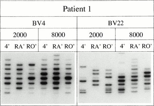 Fig. 5. The repertoire of the CD4+CD45RA+RO− T cells is diverse. The respective lanes show the bands generated by 2,000 or 8,000 T cells sorted on the basis of their CD4+CD45RA+RO− or CD4+CD45RA−RO+ phenotype.