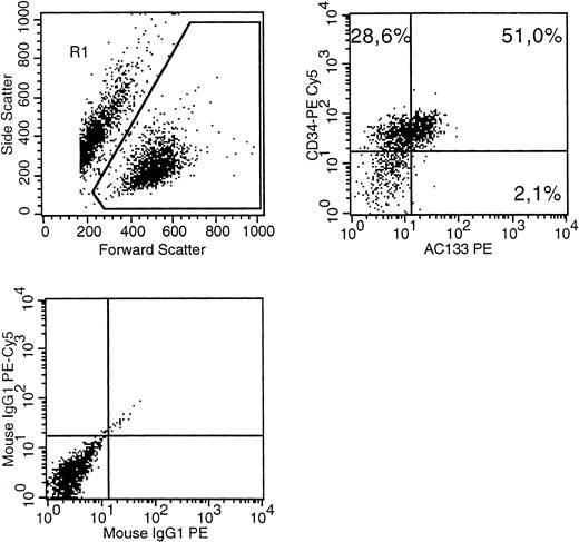 Fig. 1. A MUTZ-2 cell sample was stained with CD34(PE-Cy5), AC133(PE) as well as isotype control antibodies conjugated with PE-Cy5 or PE. (Top left) The gate on forward versus side scatter (1) contained the leukemic blast cell population (10% probability dot plot). (Top right) Expression of CD34 and AC133 on gated (R1) cells is shown. (Bottom left) The pattern of IgG-PE-Cy5 and IgG-PE isotype MoAb expression on the R1 population.