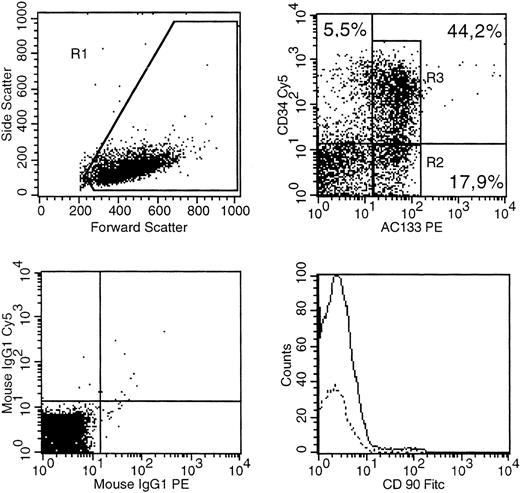 Fig. 2. A bone marrow sample (53-year-old male AML:M4) was stained with CD34(PE-Cy5), AC133(PE). CD90 (FITC) as well as isotype control antibodies conjugated with PE-Cy5, PE, FITC. (Top left) The gate on forward versus side scatter (1) contained the leukemic blast cell population (10% probability dot plot). (Top right) Expression of CD34 and AC133 on gated (R1) cells is shown. (Bottom right) Expression of CD90 in R2 (dotted line) versus R3. (Bottom left) The pattern of IgG-PE-Cy5 and IgG-PE isotype MoAb expression on the R1 population.