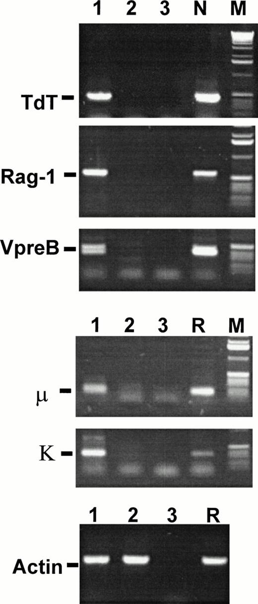 Fig. 1. B progenitors from HB-LTC express mRNA for TdT, Rag, VpreB, μ, and light chain. RT-PCR was performed using the primer pairs as described in Materials and Methods with (lane 1) RNA from nonadherent cells of 8-week-old HB-LTC; (lane 2) RNA from S17 cells grown in the same conditions without addition of the CD34+ progenitors; (lane 3) no added RNA; (N) RNA from the human pre-B–cell line, Nalm-6; or (R) RNA from the human IgM+ immature B-cell line, Ramos. Lane M contains DNA size standards. Results are representative of at least three independent experiments using unrelated HB-LTCs.