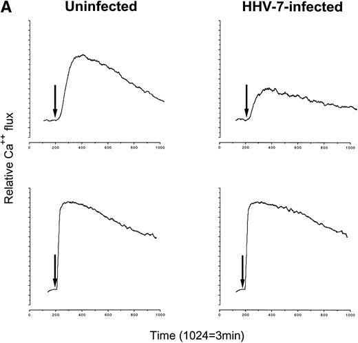 Fig. 2. Mobilization of calcium (A) and chemotaxis (B) of uninfected and HHV-7–infected SupT1 cells in response to SDF-1. HHV-7–infected cultures were analyzed at days 4 (A) or 6 (B) PI. (A) shows transient intracellular calcium flux in response to SDF-1 (40 ng/mL; top panels) or to ionomycin (100 ng/mL; bottom panels). Data are representative of three independent experiments. In (B), chemotaxis was analyzed by using Transwells after induction with the indicated concentration of SDF-1. Data are expressed as the percentage of input cells transmigrated. The mean ± SD of three independent experiments is shown.