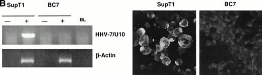 Fig. 4. Effect of SDF-1 on HHV-7 infection. (A) SDF-1–dependent CXCR4 downmodulation (left panel) and inhibition of HHV-7 infection (right panel). SupT1 cells were preincubated with SDF-1 (2.5 μg/mL) for 30 minutes at room temperature and then either remained uninfected or inoculated with HHV-7. Before HHV-7–infection, surface CXCR4 was analyzed by flow cytometry (left panel). Horizontal axis, surface CXCR4 expression detected by PE fluorescence intensity; vertical axis, relative cell number. Negative control (Cont) is represented by cells stained with irrelevant isotype-matched control MoAb. The right panel shows HHV-7 expression determined by specific RT-PCR in SupT1 cells preincubated with nothing (lane 1), 2.5 μg/mL of SDF-1 (lane 2), 25 μg/mL of control mouse IgG2a (lane 3), and 25 μg/mL of 12G5 anti-CXCR4 MoAb (lane 4). Equivalent amounts of RNA, extracted at 40 hours PI, were used as template for RT-PCR using either HHV-7–specific primers (U10 ORF) or β-actin primers. Control reaction, performed by amplifying the same RNA samples before RT (−RT) is also shown; lane BL, blank. The data are representative of three separate experiments. (B) CD4+ SupT1 or CD4− BC7 cells were inoculated with HHV-7 and monitored for HHV-7 expression and replication by specific viral RT-PCR at 40 hours PI (left panels) and by indirect immunofluorescence at 8 days PI (microphotographs). For RT-PCR, equivalent amounts of RNA samples, before (−) and after (+) RT, were used as template for the amplification reactions. PCR products for HHV-7/U10 ORF and β-actin are shown; lane BL, blank. Immunofluorescence microscopy was performed as described by using the 5E1 HHV-7–specific MoAb; negative reactions are counterstained with Evans blue. The data are representative of three experiments from separate infections.
