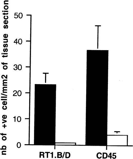 Fig. 6. The effect of pretreatment of the donor with cyclophosphamide on leukocyte content in heart. Cryostat section of heart tissue samples from untreated (▪) or cyclophosphamide-treated (□) donor rats were labeled with OX1+OX30 (CD45) and OX6 (class II MHC) MoAbs using a three-step immunoperoxidase technique. Positive cells were counted using a grid in ocular eyepiece and each bar represents the mean ± SD of 4 animals in each group.