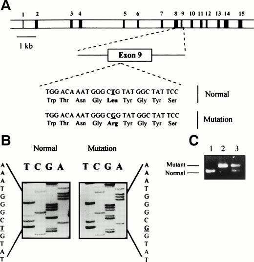 Fig. 2. Identification of L394R mutation. (A) Schematic representation of human γ-glutamyl carboxylase gene structure showing the situation of exons. In detail is a fragment of exon 9 sequence containing the nucleotide substitution at codon 394. The transversion T to G (underlined) at that position causes a Leucine to Arginine replacement in the protein. (B) Direct sequencing of the genomic DNA from one patient depicts homozygosity for the mutation. (C) Analysis of L394R mutation by PCR. Electrophoresis of amplified DNA using the mutated oligonucleotide designed to introduce an Alu I restriction site in normal allele but not in mutant allele. Lane 1, normal control; lane 2, patient’s DNA homozygous for the mutant allele; lane 3, heterozygous pattern.