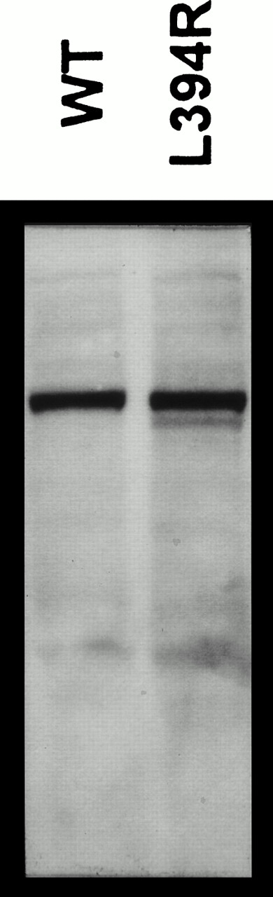 Fig. 3. Ten microliters (an amount equal to that for enzymatic assays) of extracts from WT and L394R γ-glutamyl carboxylase was fractionated by reducing sodium dodecyl sulfate-polyacrylamide gel electrophoresis. After Western blotting, the proteins were identified by luminescence from antibodies directed against the histidine tag.