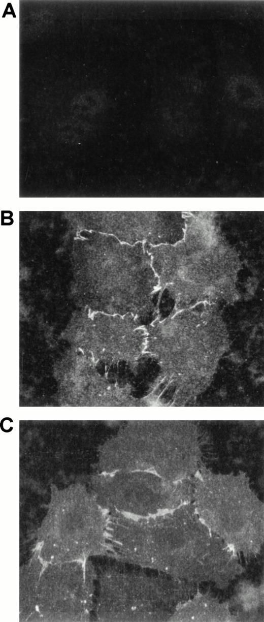 Fig. 8. PRR2 expression on HUVEC by confocal microscopy. After trypsinization, HUVEC were plated on coverslips for 6 hours. Nonconfluent HUVEC were stained with an isotypic-matched control antibody (A), the MoAb R2.477 (B), and the MoAb against PECAM-1/CD31 (C) and then with goat antimouse FITC antibody. Confocal acquisitions were then performed at a 63× magnification.