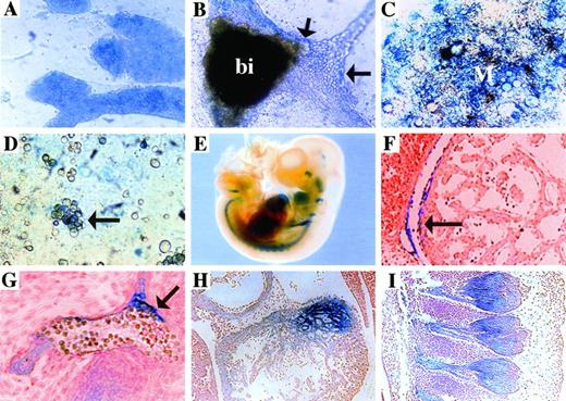 Fig. 2. K17G2-lacZ expression in vitro and in vivo. Overnight X-gal staining showed fusion transcript expression at medium intensity in most undifferentiated K17G2 ES cells (A). The fusion transcript was expressed in the blood island (bi) and some of the associated vascular endothelium (arrows) in attached EB culture (B). Differentiation of clone K17G2 on OP9 stromal cells demonstrated lacZ expression in mesodermal (M) colonies (C) and hematopoietic clusters (arrow; D). X-gal staining of an e10.5 F1 embryo demonstrated limitedlacZ expression in the embryo (whole mount; E). An X-gal stained e12.5 F1 embryo demonstrated lacZexpression in the pericardium (F) and vascular endothelium and circulating hematopoietic cells (G). In addition, the myocardium (H) and the dorsal root ganglia (I) also express the lacZ fusion protein.