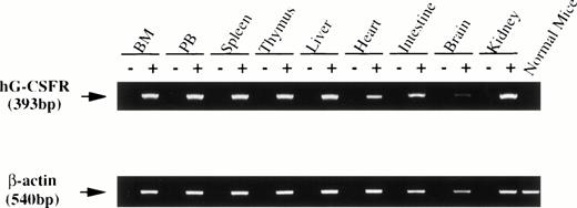 Fig. 3. RT-PCR analysis of transgene expression. RNA was prepared from various tissues of hG-CSFR-Tg mice in line #70. cDNA derived from 1 μg total RNA was used for PCR. The lane marked (−) is the PCR product of a mock cDNA (no reverse transcriptase included in the cDNA synthesis reaction). Normal mouse indicates the PCR product of the bone marrow. PCR was performed for 30 cycles. Expression of the hG-CSFR transgene was observed in BM, PB, spleen, thymus, liver, heart, intestine, brain, and kidney.