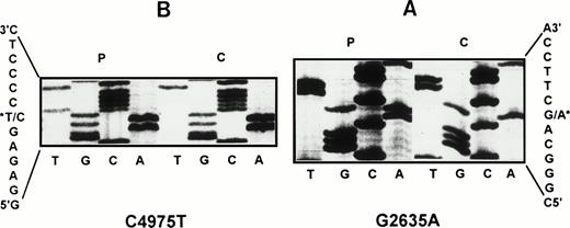 Fig. 2. Identification of two mutations in patient’s vWF gene. Part of the nucleotide sequence gels of amplified vWF exon 20 (A) and exon 28 (B) for both normal control (c) and patient (p) are shown. The asterisks localize the point mutations: (A) the indicated G2635→A transition alters the encoded sequence from Asp 116 to Asn; (B) the indicated C4975→T transition alters the encoded sequence from Arg896 to stop codon.