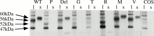 Fig. 2. Expression of wild-type and variant AT cDNA in mammalian cells. COS 7 cells were transiently transfected with pcDNA3 vector constructs containing wild-type (WT), or variant AT cDNAs encoding P, M, V, T, G, or R at position –10, or with deletion (Del) of –10L. Cell lysate (l) and culture supernatants (s) were subsequently immunoprecipitated with polyclonal AT antibody. Mock-transfected COS 7 cells (COS) indicate nonspecific binding in the cell lysates. AT is exported to the supernatant only in cells transfected with the wild-type, -10M, -10V and –10L deletion constructs. The substitution of –10L by P, T, G, or R blocks processing and export of the variant AT proteins, with cell lysates showing the presence of only unprocessed and internally initiated protein. See Results for an interpretation of band sizes.
