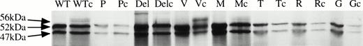 Fig. 3. Cell-free translation of AT cDNA constructs performed in the presence (c) or absence of microsomes. Wild-type, -10M and -10V AT constructs undergo modification in the presence of microsomes to generate a 56-kD species, consistent with N-linked glycosylation, indicating that the protein has been translocated into microsomes.