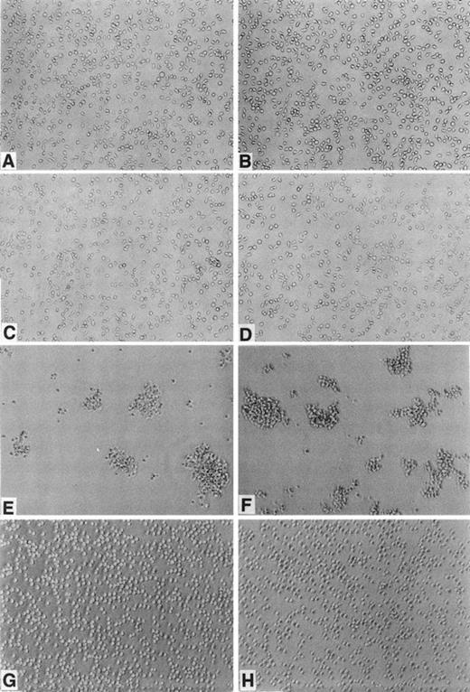 Fig. 2. Morphological properties of BAF-B03–derived cells. BAF-B03 (A), BER2 (B), BC (C), and BM (D) cells were cultured in the presence of IL-3, whereas BMC (E), BEMC (F) , BEME (G), and BEMD3 (H) cells were cultured in the absence of IL-3. The addition of IL-3 does not alter the cell cluster-forming properties of BMC, BEMC, BEME, and BEMD3 cells.