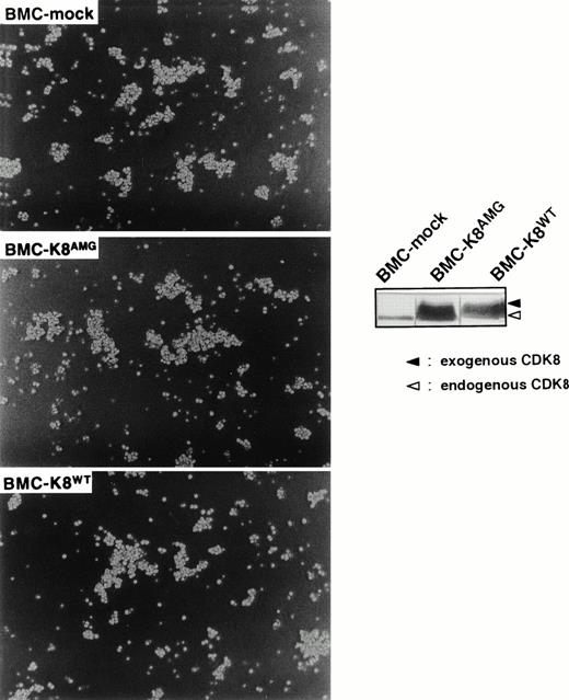 Fig. 3. Effect of enforced expression of a catalytically inactive mutant of CDK8 on the homotypic cell adhesion of BMC cells. Morphological properties of BMC-mock, BMC-k8AMG, and BMC-k8WT are shown. Expression of CDK8 was detected by anti-CDK8 antibody (inset panels). Upper and lower bands indicate Myc-tagged exogenous CDK8 and endogenous CDK8.