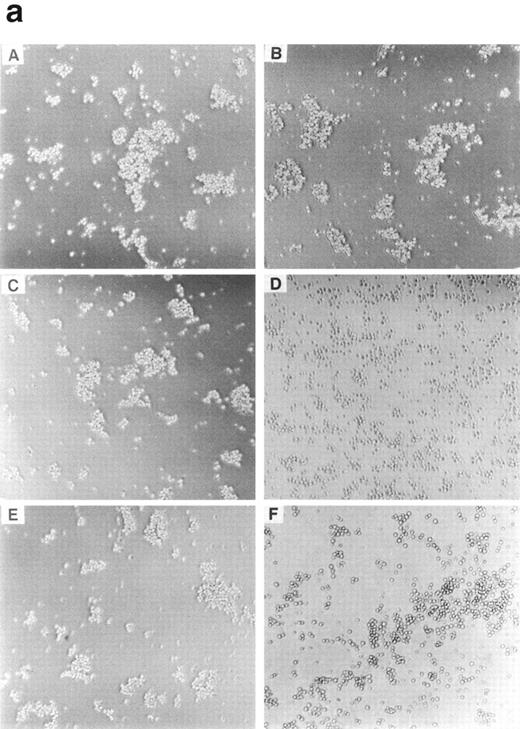 Fig. 5. (a) Antibody-blocking analysis of homotypic cell adhesion of BMC cells. Morphological properties of BMC after treatment with a control nonblocking anti-β2 MoAb (A), anti-L (B), anti-v (C), anti-4 (D), as well as anti–ΙCΑΜ-1 (E) and anti–VCAM-1 MoAb (F) are shown. (b) Effects of anti-4integrin and anti–VCAM-1 MoAbs on early phase of homotypic aggregation of BMC cells. The cells are pretreated by 10 μg/mL of human Ig, divided into effector cells (labeled with hydroethidine) and target cells (labeled with sulfofluorescein diacetate) at a 4:1 ratio, added to 1 μg/106 cells of indicated MoAbs, and enumerated using a flow cytometric analysis. Data are reported as the percentage of total targets presented as conjugates. The conjugated percentage is shown in the top, right-hand corner of each panel.