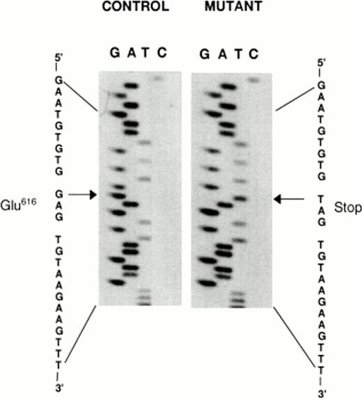 Fig. 3. Identification of a G1846→T mutation in exon 11 of GPIIIa. Exon 11 of GPIIIa was amplified from genomic DNA as described in Materials and Methods. The amplification products were cloned in a T-vector and the primary nucleotide sequence of pooled DNA was determined in both directions. The figure shows a fragment of the sequencing ladder of the sense strand. The arrows point to a homozygous G1846→T transversion that changes Glu616→Stop.