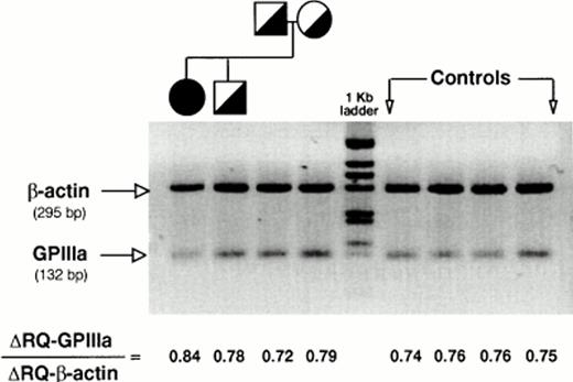 Fig. 5. PCR-based determination of platelet mRNA-GPIIIa. PCR-based quantitation of β-actin and GPIIIa mRNAs in platelets from the proband, heterozygous relatives, and normal individuals was performed using the instrumentation and the fluorogenic probes of the Perkin-Elmer Cetus LS-50B TaqMan System as described in Materials and Methods. R and Q denote the fluorescence of the reporter and the quencher dyes, respectively. Values were corrected for internal quenching and expressed as GPIIIa/β-actin fluorescence ratios.