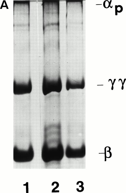 Fig. 1. Electrophoretic characterization of plasmic derivatives of fibrin. (A) SDS polyacrylamide gel electrophoresis of cross-linked fibrin (lane 1) and cross-linked fibrin after exposure to t-PA (1 μg/mL) for 1 hour (lane 2) or 4 hours (lane 3). After 2 and 4 hours, 9% and 26%, respectively, of the original fibrin clot had been solubilized. Electrophoresis of reduced protein was performed using 7% polyacrylamide gels. The locations of the polypeptide chains are indicated. (B) SDS polyacrylamide gel electrophoresis of digests of fibrin after incubation with plasmin for 45 minutes, 1 hour, 2 hours, and 3.5 hours in lanes 1 through 4, respectively. The percentage degradation of the original fibrin was 4% at 45 minutes, 5% at 1 hour, 11% at 2 hours, and 12% at 3.5 hours. The location of fragment E and the smallest cross-linked degradation products (DD, DY, and YY) are indicated. Electrophoresis of nonreduced protein was performed in 4% to 10% gradient gels.