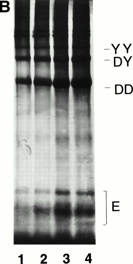 Fig. 1. Electrophoretic characterization of plasmic derivatives of fibrin. (A) SDS polyacrylamide gel electrophoresis of cross-linked fibrin (lane 1) and cross-linked fibrin after exposure to t-PA (1 μg/mL) for 1 hour (lane 2) or 4 hours (lane 3). After 2 and 4 hours, 9% and 26%, respectively, of the original fibrin clot had been solubilized. Electrophoresis of reduced protein was performed using 7% polyacrylamide gels. The locations of the polypeptide chains are indicated. (B) SDS polyacrylamide gel electrophoresis of digests of fibrin after incubation with plasmin for 45 minutes, 1 hour, 2 hours, and 3.5 hours in lanes 1 through 4, respectively. The percentage degradation of the original fibrin was 4% at 45 minutes, 5% at 1 hour, 11% at 2 hours, and 12% at 3.5 hours. The location of fragment E and the smallest cross-linked degradation products (DD, DY, and YY) are indicated. Electrophoresis of nonreduced protein was performed in 4% to 10% gradient gels.