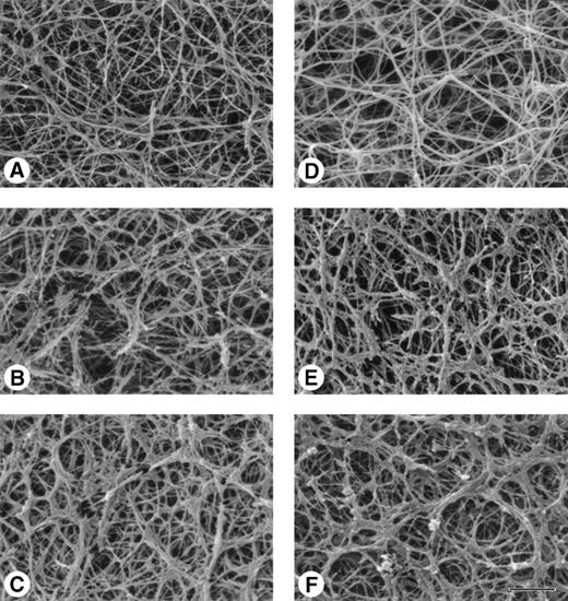 Fig. 2. Scanning electron micrographs of digested clot surfaces. Different concentrations of plasmin were applied to the clot surface and samples were prepared for microscopy at various times. (A) 0.2 U/mL plasmin, 30 minutes. (B) 0.2 U/mL plasmin, 1 hour. (C) 0.2 U/mL plasmin, 3.5 hours. (D) Control, no plasmin. (E) 0.5 U/mL plasmin, 30 minutes. (F) 2.0 U/mL plasmin, 3.5 h. Bar equals 2 μm.