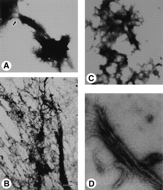 Fig. 4. Transmission electron micrographs of negatively contrasted digestant removed from the clots. Large pieces of clot observed in the supernatants. (A) This chunk consisting of pieces of fibers and aggregated smaller structures has been cleaved so that it is nearly separated from a larger mass at the location indicated by the arrow. (B) Lacy meshwork of fibers, protofibrils, and other cleaved pieces. (C) Aggregate consisting of pieces of fibers and smaller structures. Bar for (A) through (C) equals 0.5 μm. (D) Fiber bundles with splayed ends. Bar for (D) equals 0.1 μm.