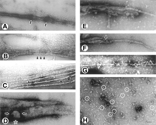 Fig. 5. Transmission electron micrographs of negatively contrasted digestant removed from the clots. Pieces of fibers, protofibril aggregates, and smaller fragments observed in the supernatants. Arrows indicate areas that are darker as a result of removal of protein by digestion. Arrowheads point out brighter areas where stain was excluded because of plasmin binding. (A) Fiber surrounded by lacy meshwork of protofibril-like structures. (B) Fiber surrounded by meshwork made up of protofibrils and other smaller structures. (C) Fiber splayed into bundles of protofibrils. Bar for (A) through (C) equals 0.5 μm. (D) Fiber showing sharply cut end (at right) and another chunk that is largely separated from the rest of the fiber but still associated with it (asterisk). (E) Digested fiber with missing pieces and truncated end; note some smaller fragments in the background. (F) Piece of remaining fiber where individual protofibrils can be visualized. (G) Very thin fiber remnant with other smaller fragments. (H) Small fragments present at longer times of digestion or with higher plasmin concentrations. Some examples of DDE complexes are circled. Bar for (D) through (H) equals 0.1 μm.