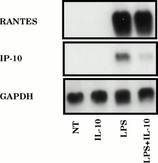 Fig. 1. IL-10 selectively suppresses LPS-induced chemokine gene expression. TG-elicited macrophages (1 × 107) were treated with LPS (10 ng/mL) in the absence or presence of IL-10 (25 ng/mL) for 2 hours. Total RNA was prepared and the levels of IP-10, RANTES, and GAPDH mRNA were analyzed using northern hybridization. Similar results were obtained in three separate experiments.